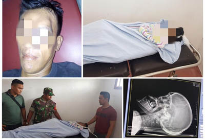 Dianiaya dengan Benda Tumpul, Warga Tagaraja Kateman Meninggal Dunia